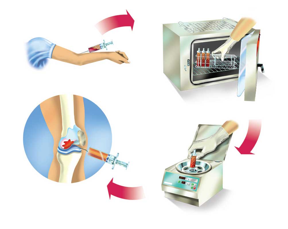 روش تهیه ارتوکین